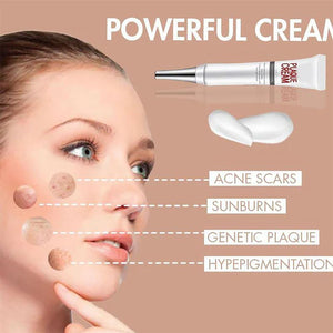 Face Freckle Removal Cream