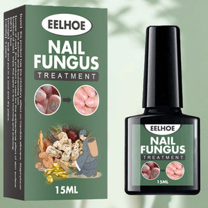 Fungal Nail Treatment