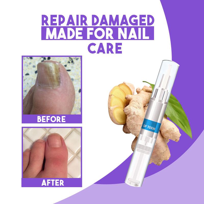 Nail Restoration Pen